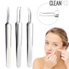 Acne extruder 3 types SET Acne extruder baby / 여드 름 압출기 3종 SET 여드 름압출기 아기