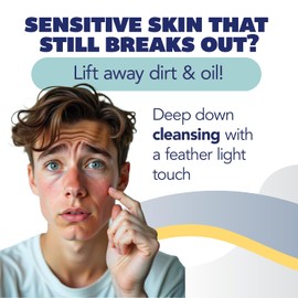 Asepxia Acne Treatment Neutral Hypoallergenic Bar Soap | 2% Salicylic Acid Cleanser, Removes Impurities & Excess Oil, Soothes Skin with Natural Botanical Extracts, Daily Use, Face Wash, 4 Oz, 1-Pack