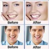 28 Tiras Blanqueadoras Dentales 5d White Higiene Bucal