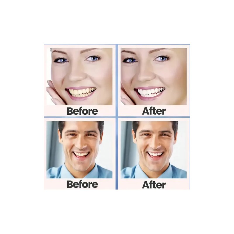 28 Tiras Blanqueadoras Dentales 5d White Higiene Bucal