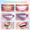 2 PCS Niacinamide Whitening Toothpaste, Intensive Whitening Toothpastes, Deep Gentle