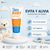 Skin Baby - Crema para Rozaduras de Bebés, Evita y