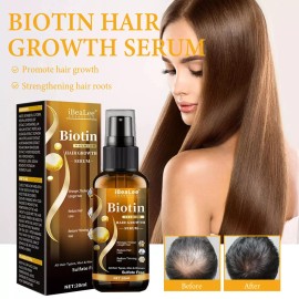 Unbranded Biotin Hair Growth Spray Anti Hair Loss Fast Regrowth Scalp Treatment Serum US