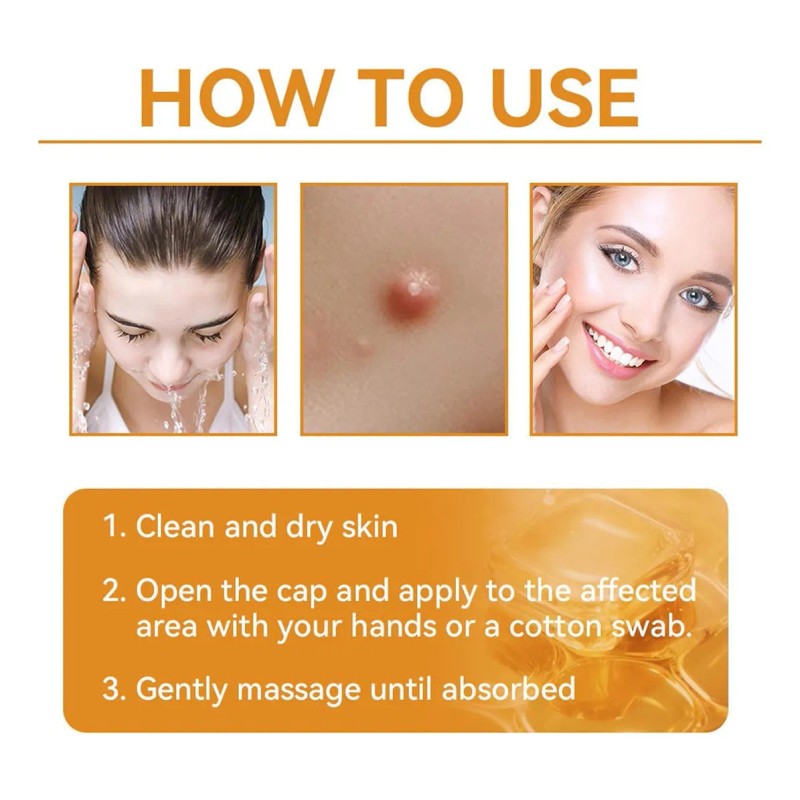 Esta Crema Suaviza La Piel, Atenúa Lunares Y Manchas, Repara