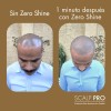 Zero Shine Spf Elimina El Brillo Y Protege Tu Cabeza