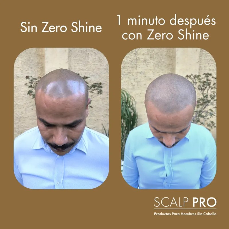 Zero Shine Spf Elimina El Brillo Y Protege Tu Cabeza
