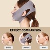 MASIKA Chin Strap for Sleeping，V-Line Mask,，V-Line Lifting Chinstrap，Jaw Exerciser, Reusable