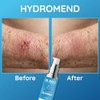 Dr. Nice's HydroMend Hydrogel for Seniors - Skin Repair Gel