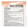 Acnomel Crema Para Adultos Acne 36gr 1.3oz