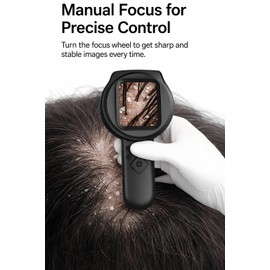 Digital Dermascope for Skin, Up to 500X Viewing, 2.8” IPS Screen, 2MP Camera, Manual Focus & 15 LED Lights, Pocket Camera for Skin & Scalp Observation