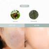 Dr.Althea [Dr.Althea]Last Minute Skin Rescue Anastatica Mask (30ea)