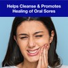 CloSYS Mouth Sore Mouthwash Cleanses and Heals Oral Sores and