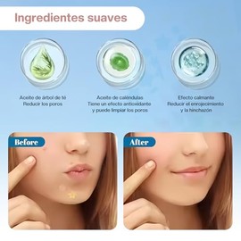 Parches para Acne：200 Piezas Almohadillas Hidrocoloides para Espinillas-Pimple Patch，Parches hidrocoloides absorbentes para tratar la erupción de acné