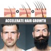 Beard Growth Kit with Rollers Beard Growth Agent Men Black