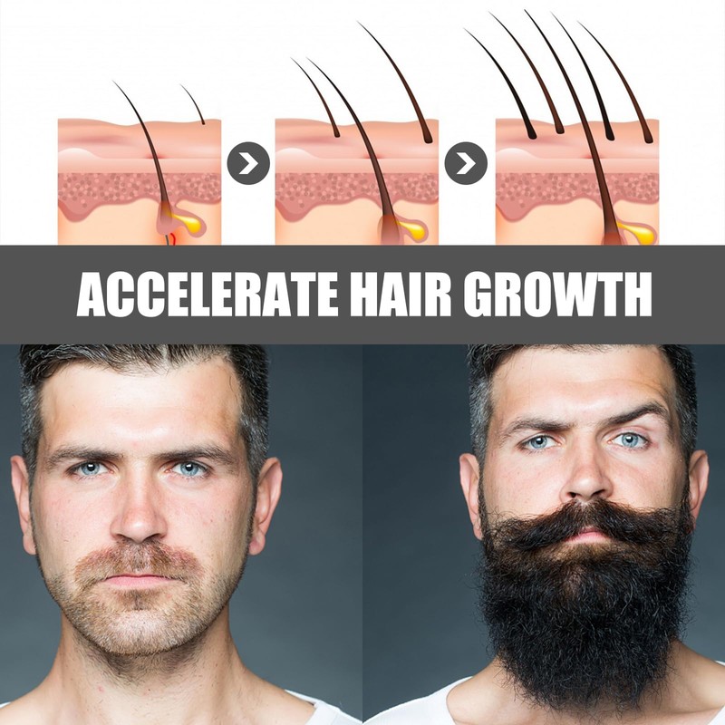 Beard Growth Kit with Rollers Beard Growth Agent Men Black