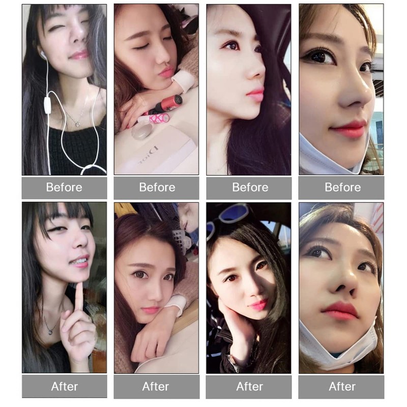 VANANA 3 Sizes Invisible Nose Lifter, Soft Silicone Nose Straightener