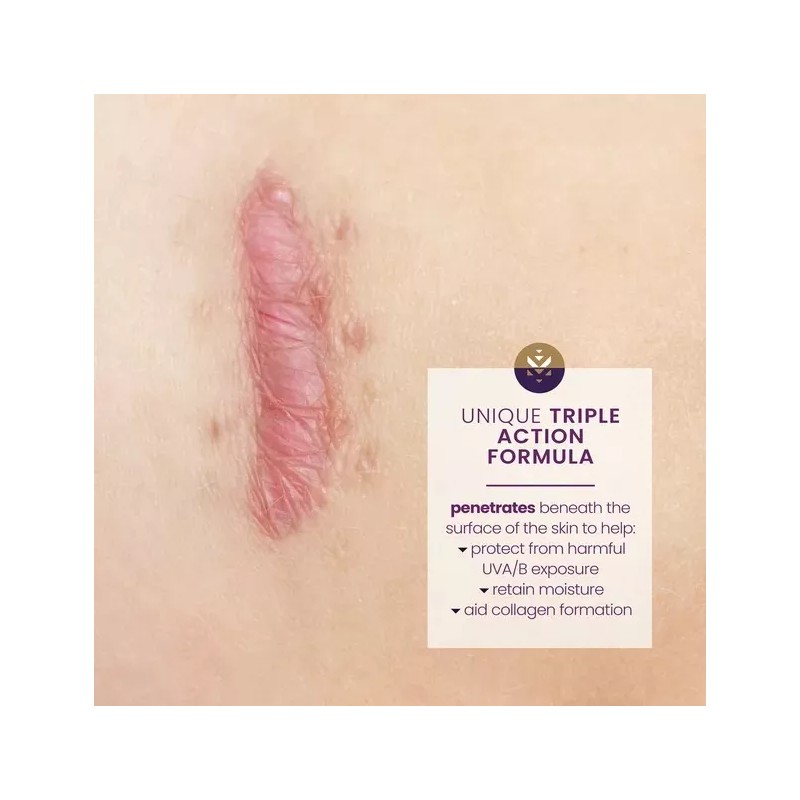 Mederma Crema Mederma Desvanece Eliminar Cicatrices Spf30 Prot Solar