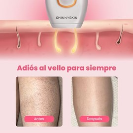 ShinnySkin - Depiladora Láser Profesional IPL para Todo el Cuerpo - Eliminación del Vello Sin Dolor - 5 Niveles de Intensidad - Resultados Notorios en