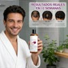 2PCS Onion Shampoo,Shampoo Reparación Brillante y Nutrición,Champú Extracto de Romero,