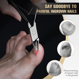 FERYES Ingrown Toenail Clippers Straight Blade Toe Nail Clippers for Thick Nails for Seniors, Stainless Steel Nail Clippers for Thick Toenails - Ultra-Slim 16mm Blade Fingernail Clippers