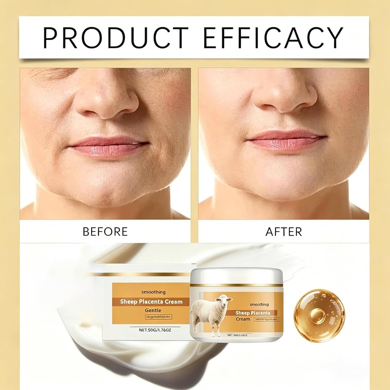 Sheep Placenta Cream，Extract Activity Collagen，Face Instant Repairing Creams，Deep Hydration，Reduce Wrinkles