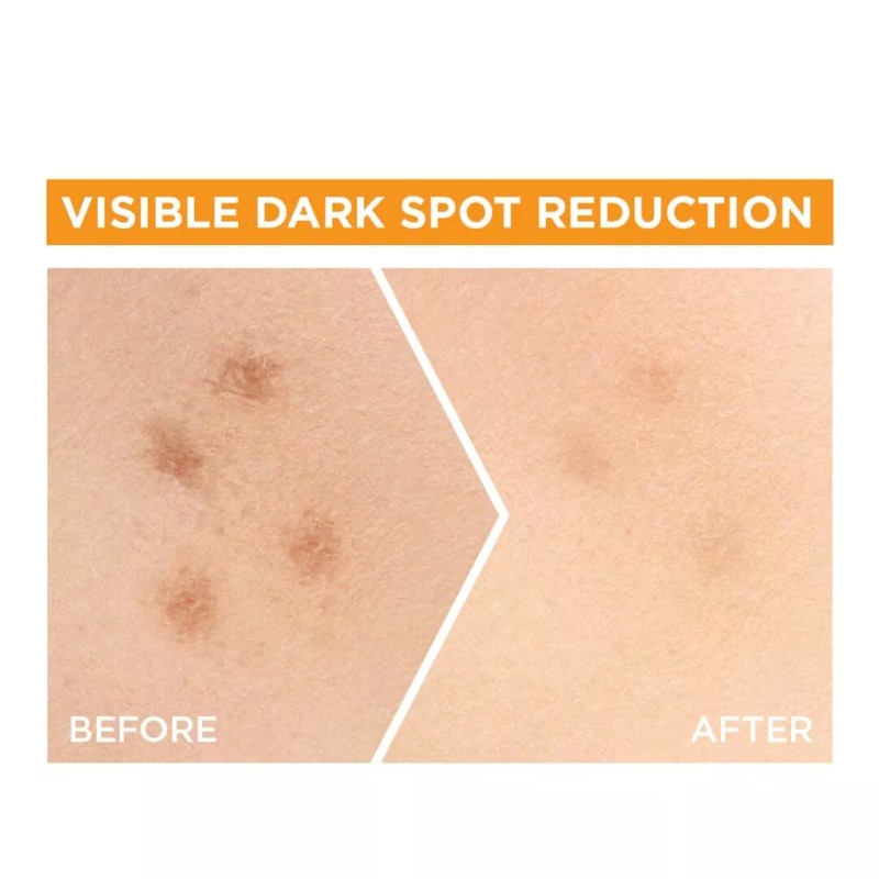 Garnier Bright Complete Vitamin C Booster Face Serum for All