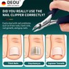 DEOU Podiatrist Toenail Clippers Ingrown Toenail Tools for Thick Nails