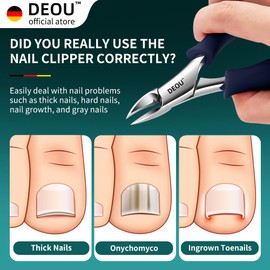 DEOU Podiatrist Toenail Clippers Ingrown Toenail Tools for Thick Nails and Inlaid Nails,Manicure and Pedicure Clippers,Heavy Duty Nail Clippers, Pedicure Tools (Dark Blue+Nail Remover)
