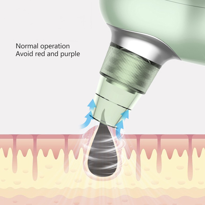 Blackhead Remover Pore Vacuum Electric Facial Deep Cleaner Rechargeable Acne