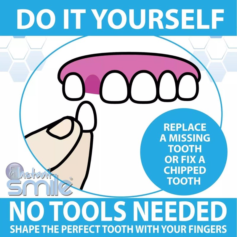Instant Smile Thermal Fitting Temporary Tooth Replacement Fitting Beads Jar