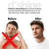Face Shine Reducer For Men with Vitamin E - Anti