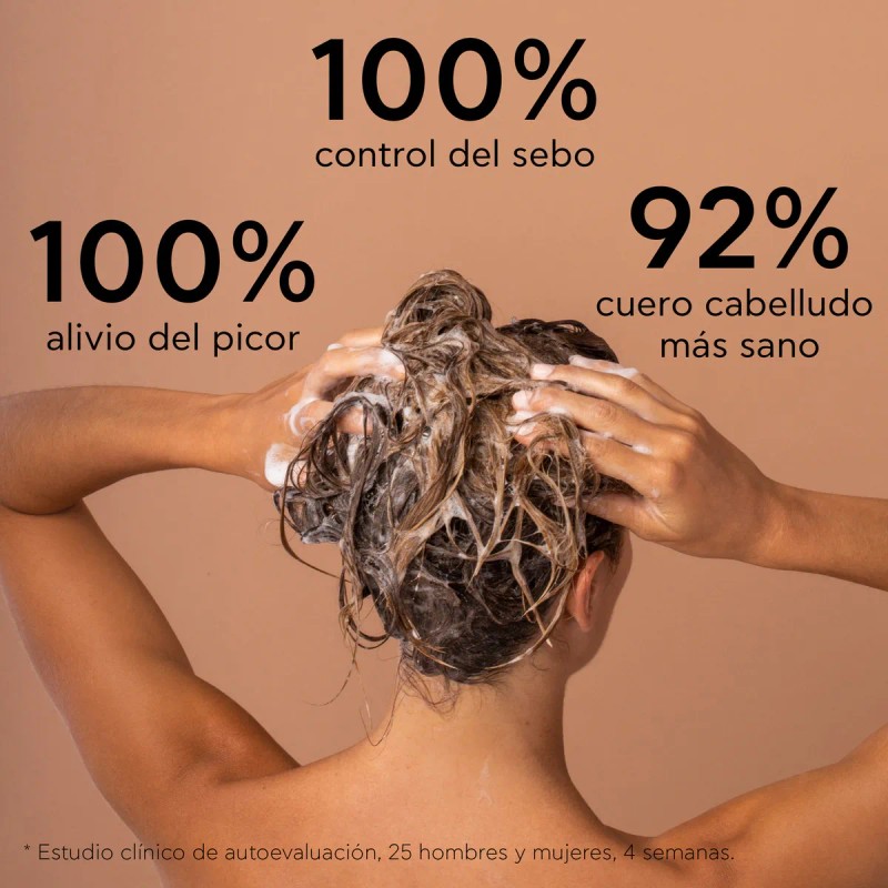 Apivita Shampoo anticaspa para cuero cabelludo graso 250ml