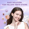 Whitening Strips for Teeth,Effective and Fast Results Teeth Whitening Trays,10