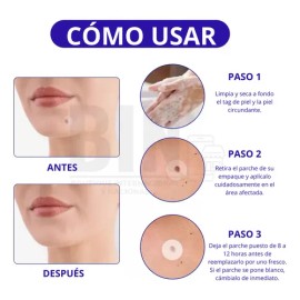 Parches Aliver Antiacné Pack 180 Unidades Día/Noche Todo Tipo De Piel
