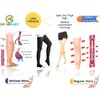 GPARMART Class 2 Medical Compression Socks, Unisex, 23-32mmHG, Closed Toe