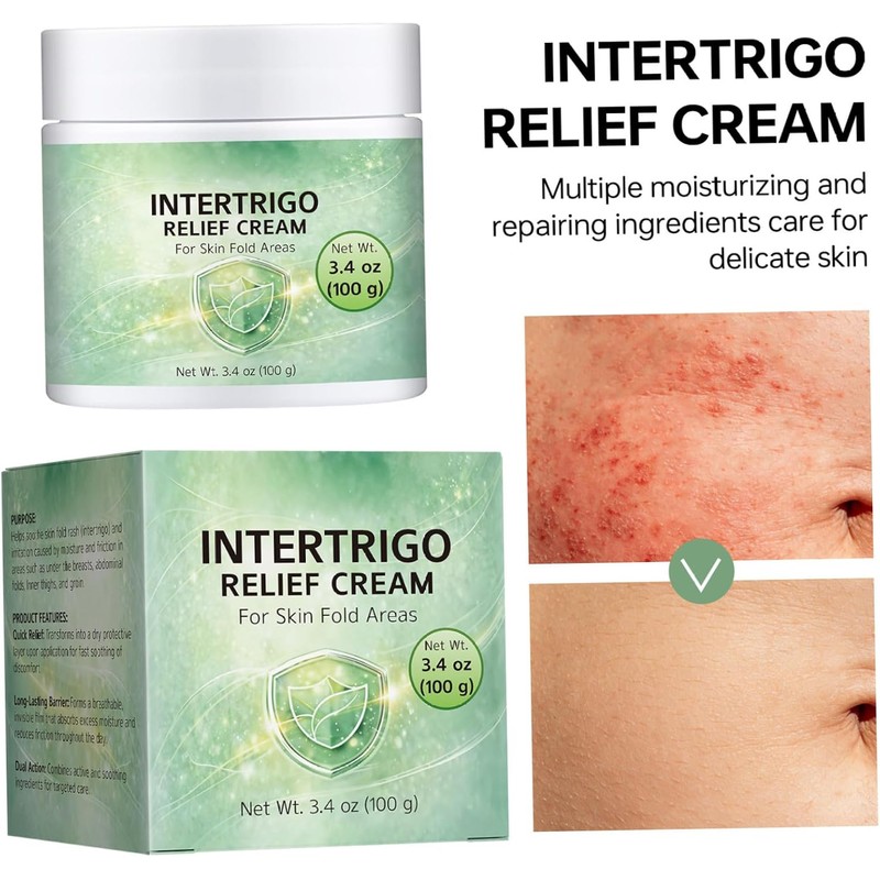 Intertrigo Relief Cream Crema hidratante protectora de la piel para