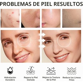 VGO- Kit de rutina de cuidado de la piel: Nuestro set de regalo para el cuidado de la piel incluye un limpiador facial suave, un tónico hidratante, una crema antienvejecimiento para el contorno de ojo