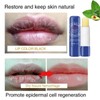 Sale!! Remove Dark Lip Balm Lighten Melanin Keeping Elasticlip Mask