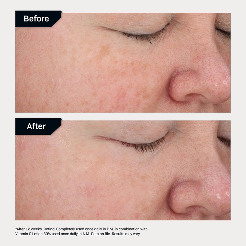 Revision Skincare Retinol Complete® 0.5 Anti Aging Serum, Reduces Fine