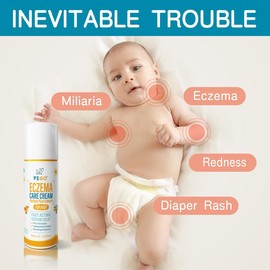 Baby Eczema Cream - Kids Eczema Therapy & Relief Body Cream, Nourishing Skin Protectant for Dry, Itchy Skin, Hypoallergenic,baby rash cream face,3.38oz/100ml - Specification: 1pcs