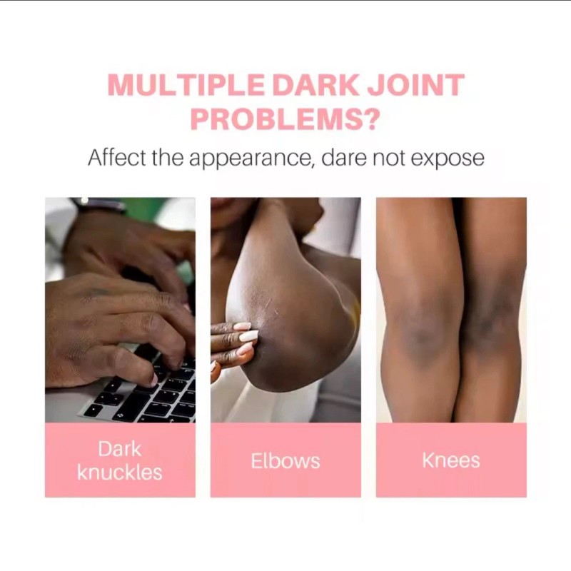 Aromixe 7 Day Whitening Serum 50ml for Knuckles, Feet, Elbows,