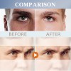 Crema De Ojos For Hombres Que Aclara Las Ojeras E