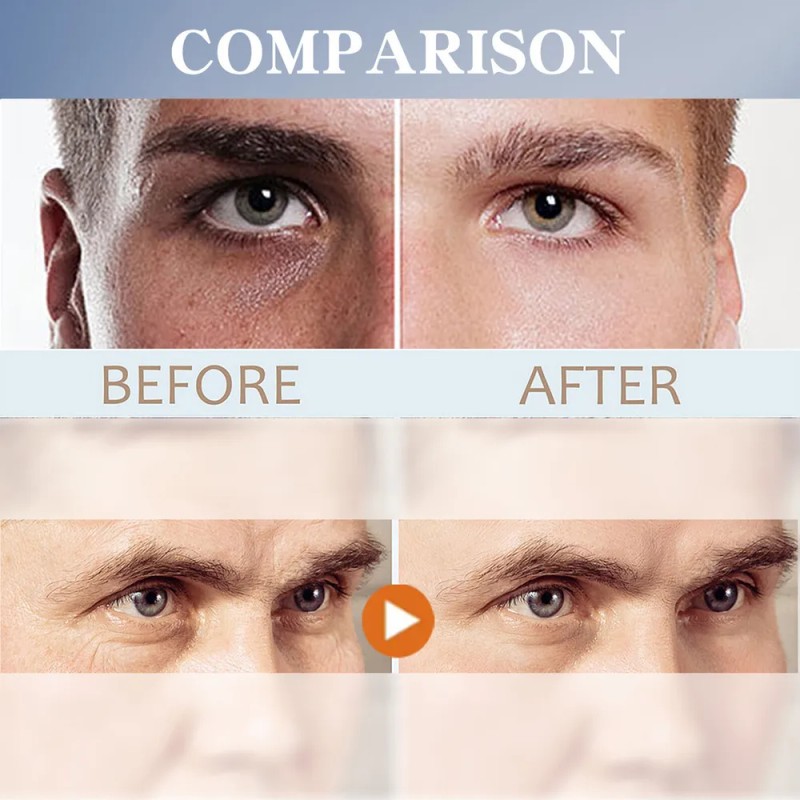 Crema De Ojos For Hombres Que Aclara Las Ojeras E