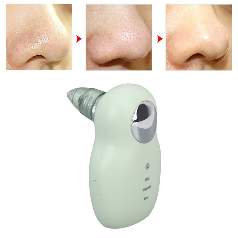 Heating Vacuum Blackhead Remover Gentle Micro Bubble 3 Suction Levels