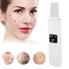Ultrasonic Face Skin Scrubber Facial Cleanser Exfoliating Remove Blackheads Pimples