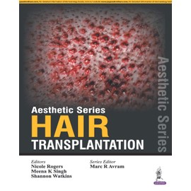 Hair Transplantation (Aesthetic)