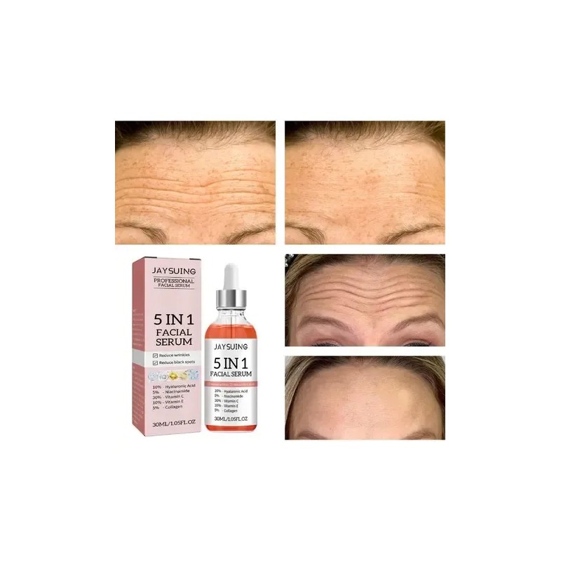 Sérum Facial Jaysuing Antiacné Niacinamida 5% 30ml Rostro