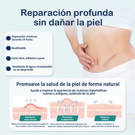 🩹✨ ¡Adiós Cicatrices! Parches de Silicona Premium - 1.5M Largo | Reduce Quemaduras, Queloides, Estrías & Acné | 💯 Reutilizable & Postquirúrgico | Para Cicatrices Nuevas y Antiguas | ¡Piel Suave y Perfecta!