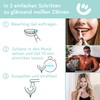 UniqueSmile High-Quality Teeth Whitening Kit, All-in-One Bundle for Teeth Brightening