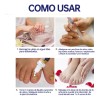 2 Piezas Líquido Reparador De Uñas De Los Pies, Paronychia